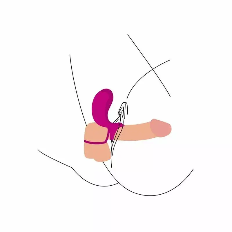 Penis Attachment XOCOON COUPLES STIMULATOR RING FUCHSIA Photo 5