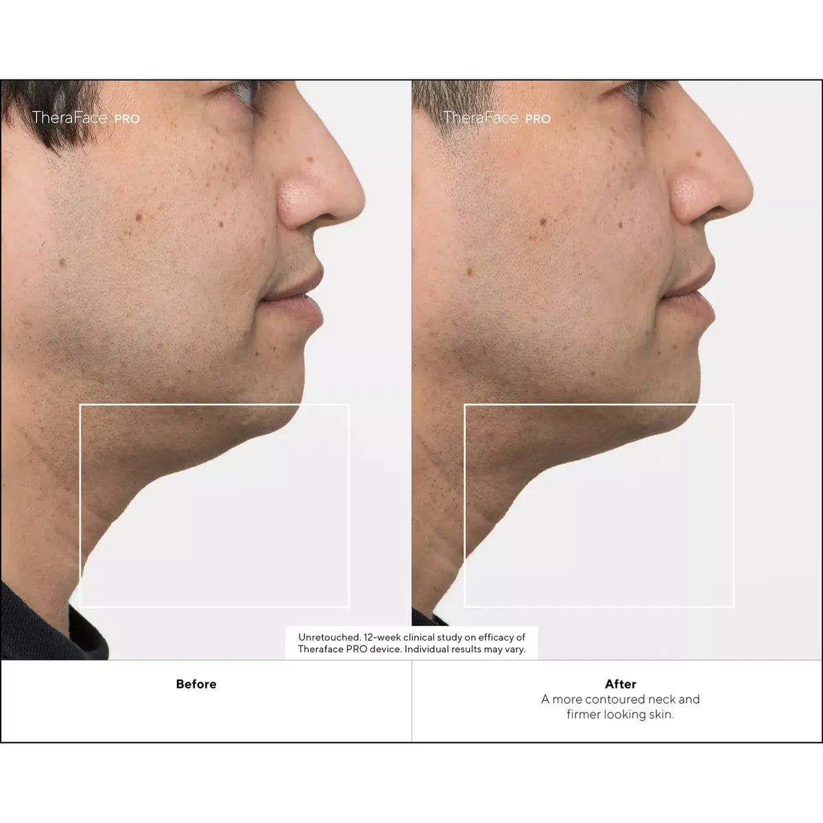 Therabody TheraFace PRO Facial Health Device - White Photo 2