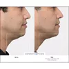 Therabody TheraFace PRO Facial Health Device - White Photo 2