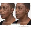 Therabody TheraFace PRO Facial Health Device - White Photo 3