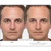 Therabody TheraFace PRO Facial Health Device - White Photo 4
