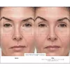 Therabody TheraFace PRO Facial Health Device - White Photo 5