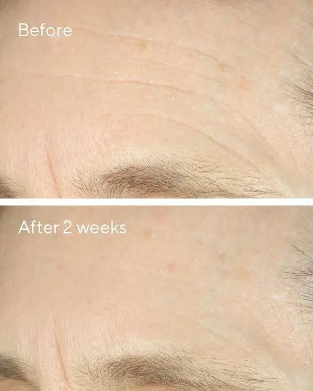 Крем для лица Murad Intense Recovery Cream 50 ml Photo 3