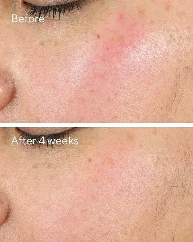 Крем для лица Murad Intense Recovery Cream 50 ml Photo 4