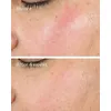 Крем для лица Murad Intense Recovery Cream 50 ml Photo 4