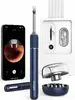 Otoscope Bebird Note 5 Pro Photo 5