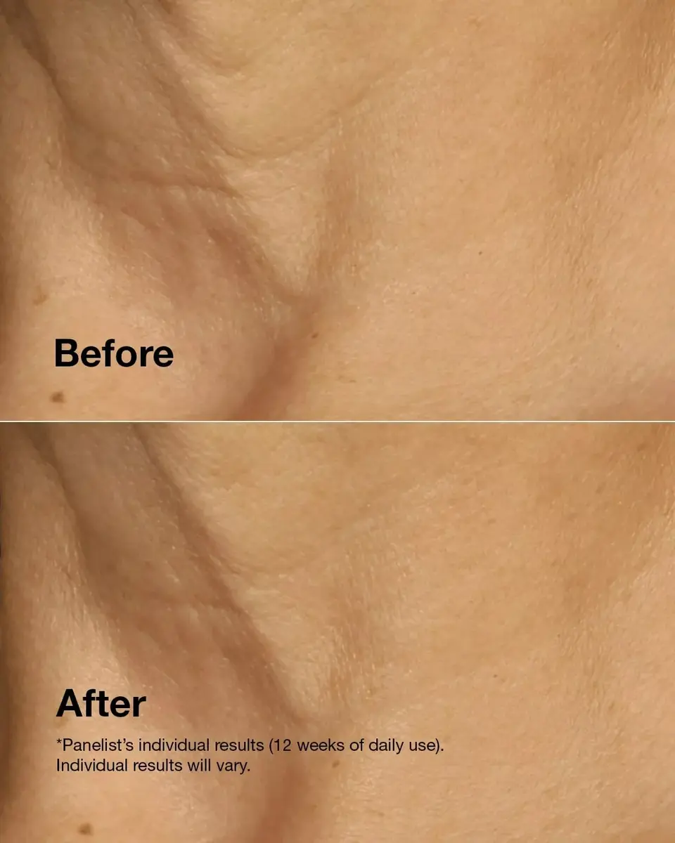 Day & night cream Clinique Smart Clinical Repair Lifting Face + Neck Cream Photo 5