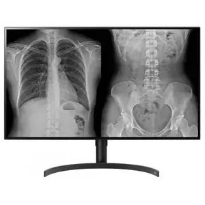 Диагностический монитор LG 31.5" 8MP, 450 cd/м², DCI‑P3 98%, с регулировкой высоты и поворотом