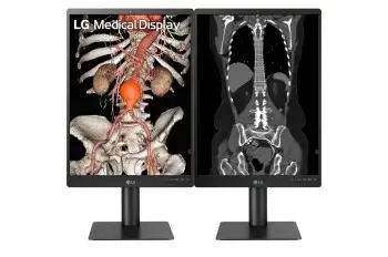 LG diagnostikas monitors 21,3" 3MP 21HQ513D-M Photo 2