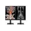 LG diagnostikas monitors 21,3" 3MP 21HQ513D-M Photo 2