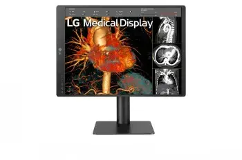 LG diagnostikas monitors 21,3" 3MP 21HQ513D-M Photo 8