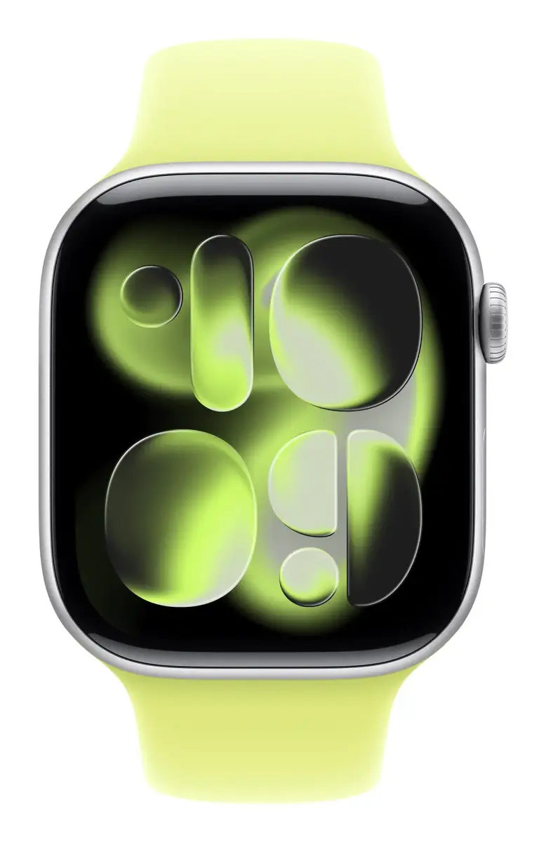 Браслет Apple 46mm Neon Yellow Sport Band Photo 3