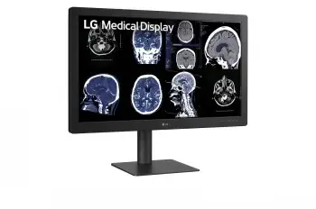 Diagnostikas monitors LG 31.5" 8MP 1000 cd/m² Photo 6