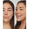 Clinique Even Better Clinical SPF 20 — WN 46 Photo 7