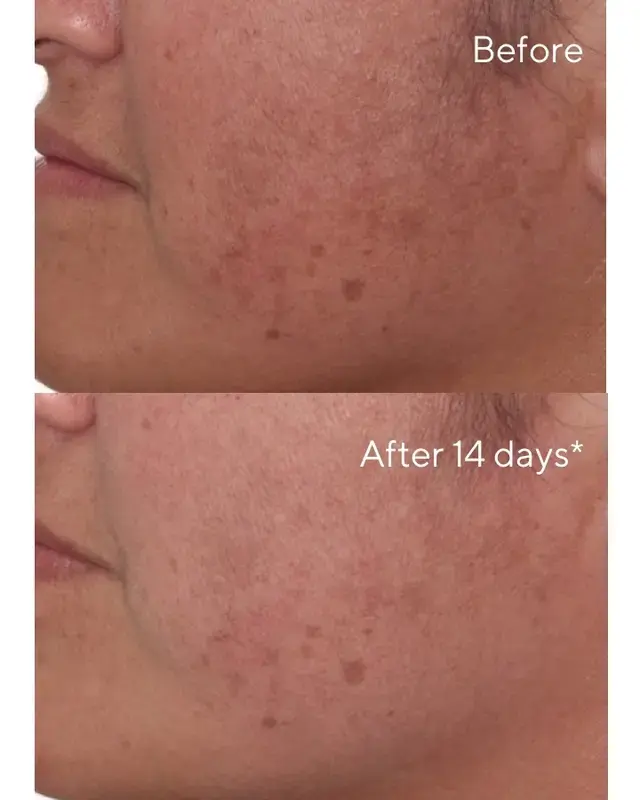 Murad Rapid Dark Spot Correcting Serum 30 мл Photo 3
