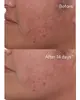 Murad Rapid Dark Spot Correcting Serum 30 мл Photo 3