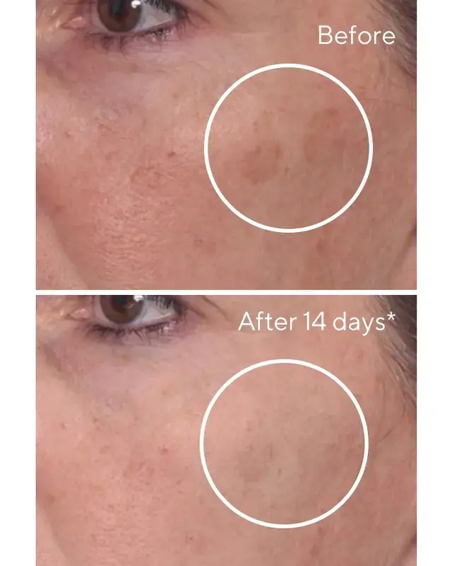 Murad Rapid Dark Spot Correcting Serum 30 мл Photo 4