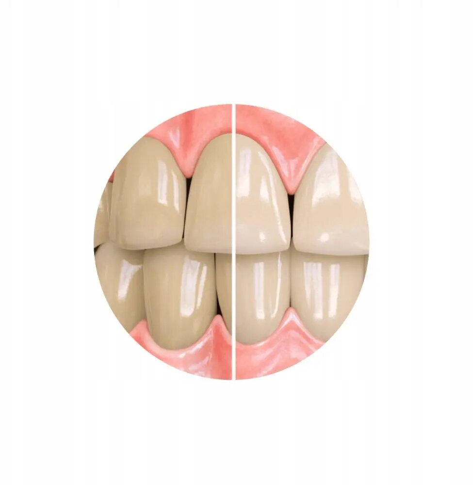 Zobu pasta Opalescence Sensitivity Relief Whitening