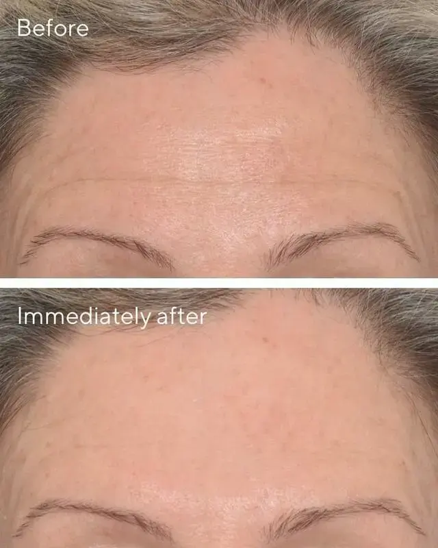 Murad Resurgence Targeted Wrinkle Corrector 15 мл Photo 4