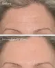 Murad Resurgence Targeted Wrinkle Corrector 15 мл Photo 4