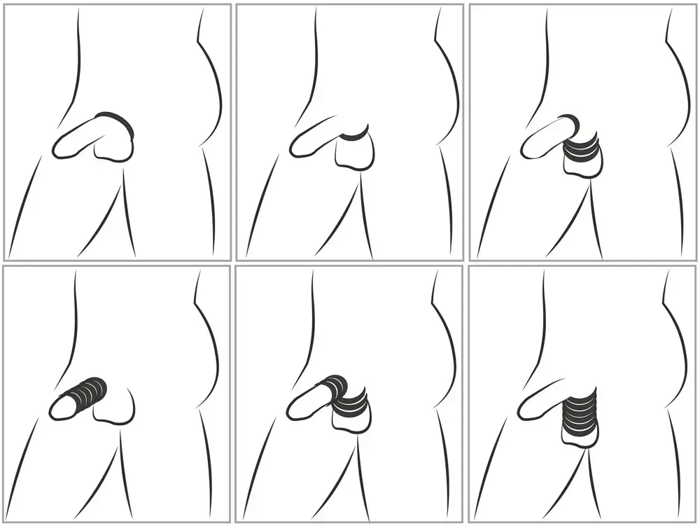 Набор колец You2Toys Cock & Ball Stretching Kit Photo 6