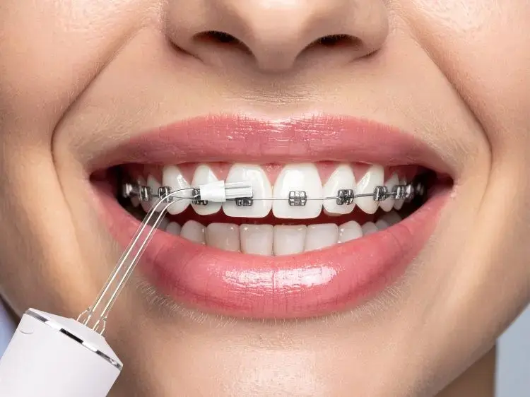 Eldom RY200B Evori Cordless Oral Irrigator Photo 3