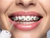 Eldom RY200B Evori Cordless Oral Irrigator Photo 3