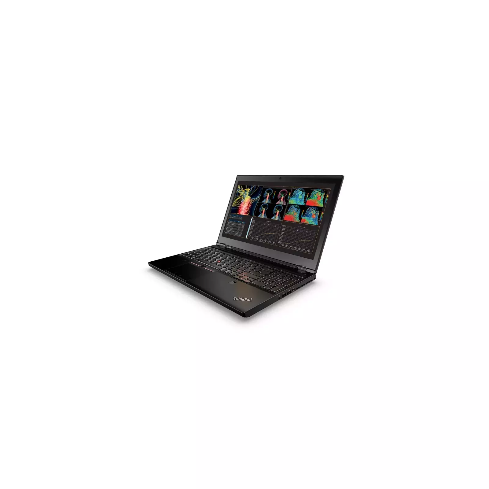 Lenovo 20HH0015MX Photo 9