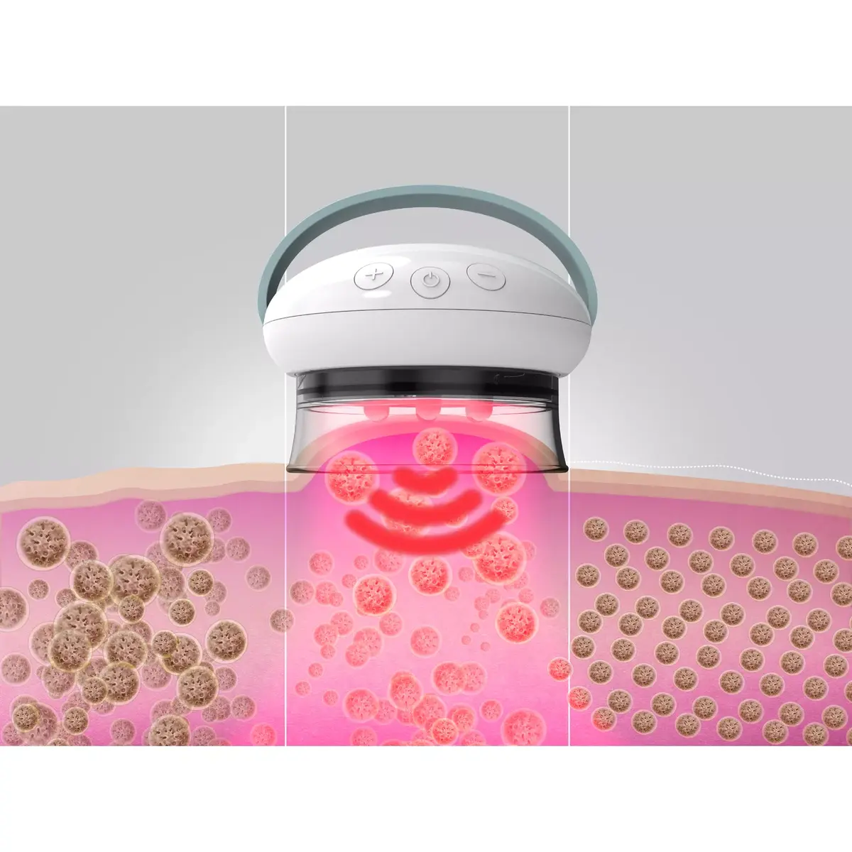Массажер для ног HoMedics Smoothee IR Photo 10